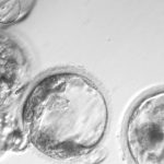 Tips On Finding The Right Stem Cell Center